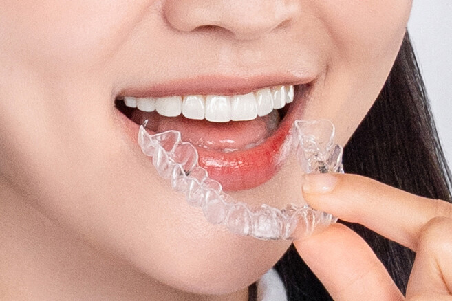 invisalign clear aligner